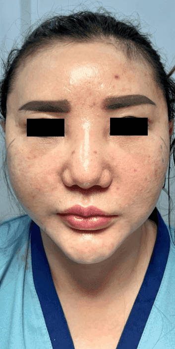 Congenital Anomalies
