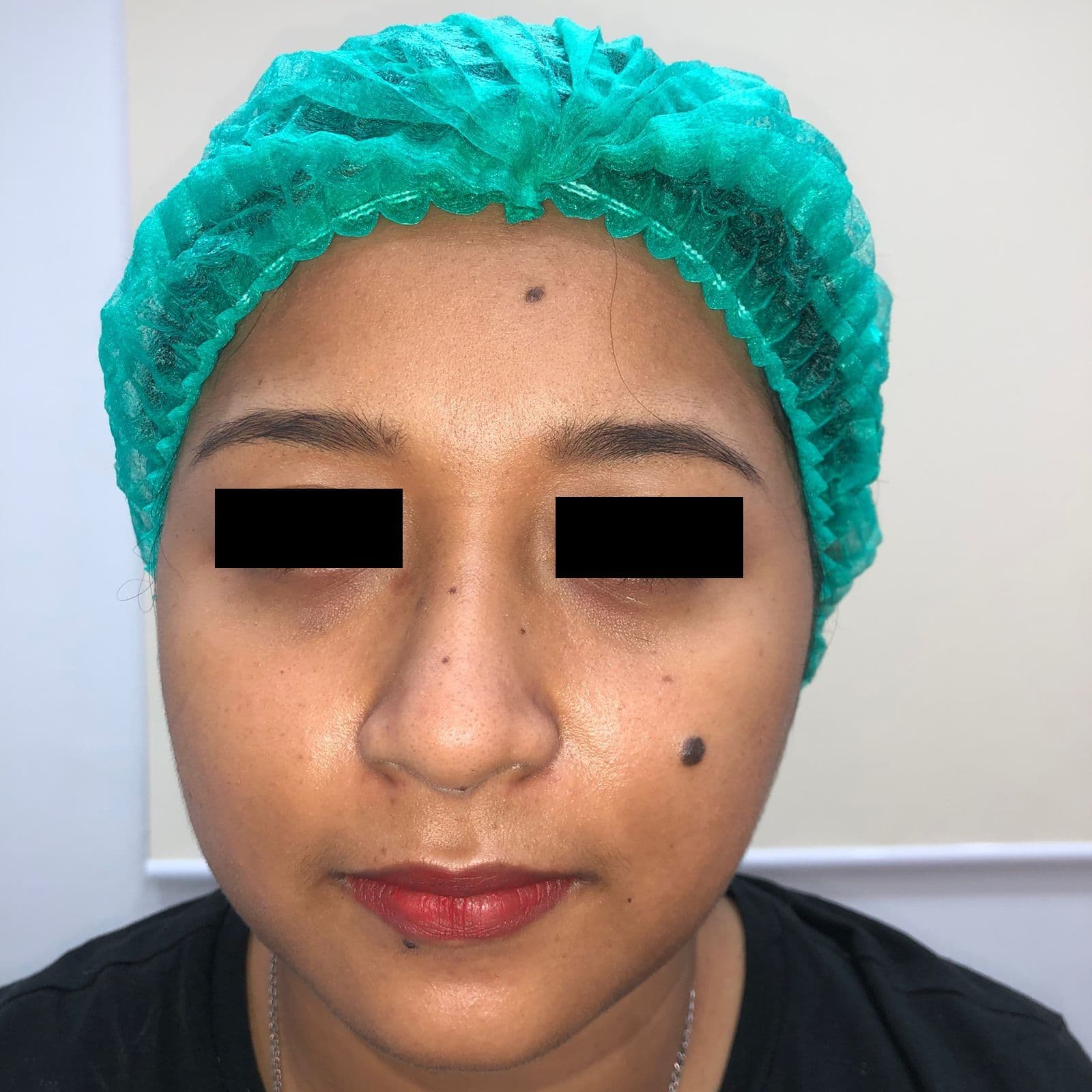 before image