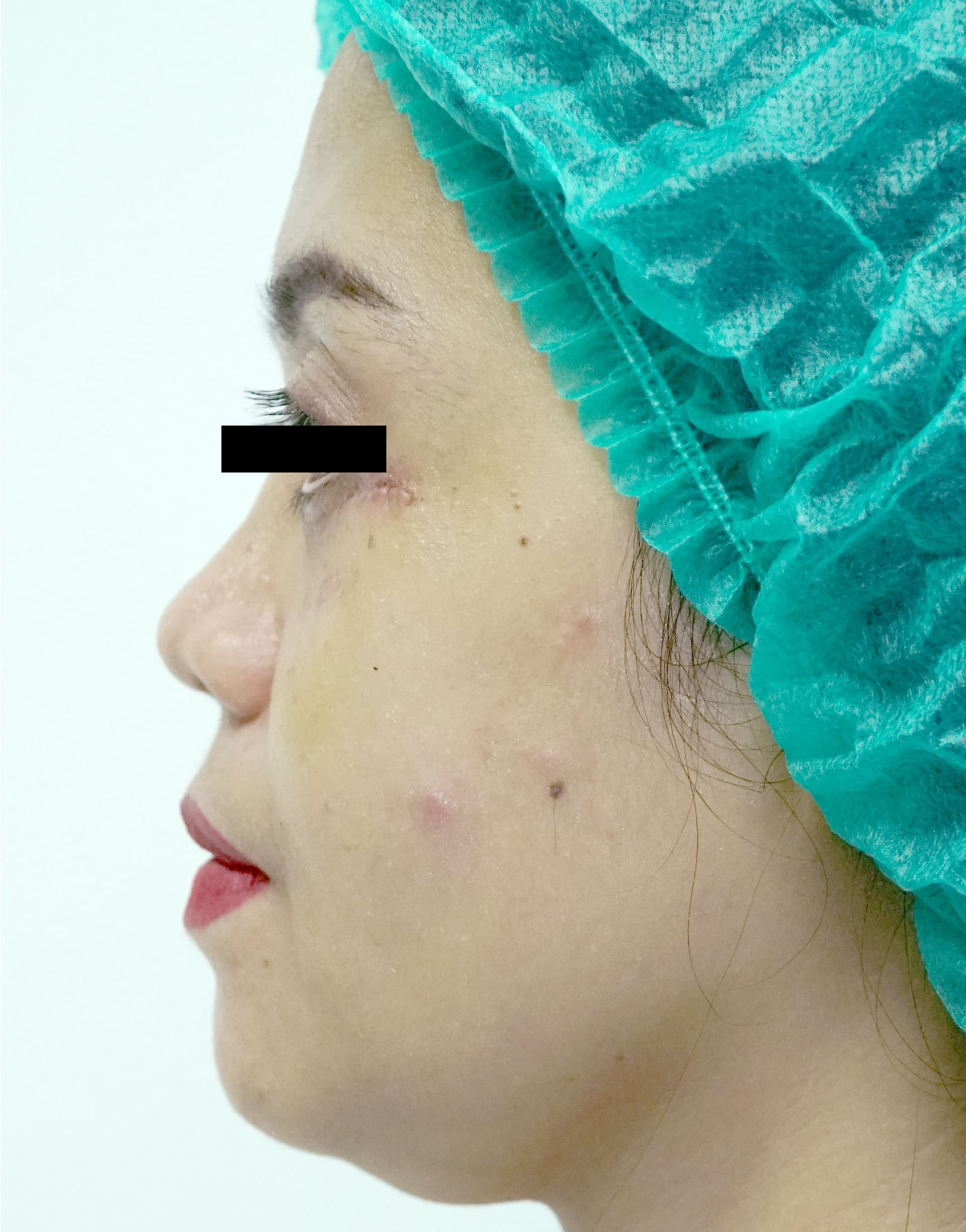 after image