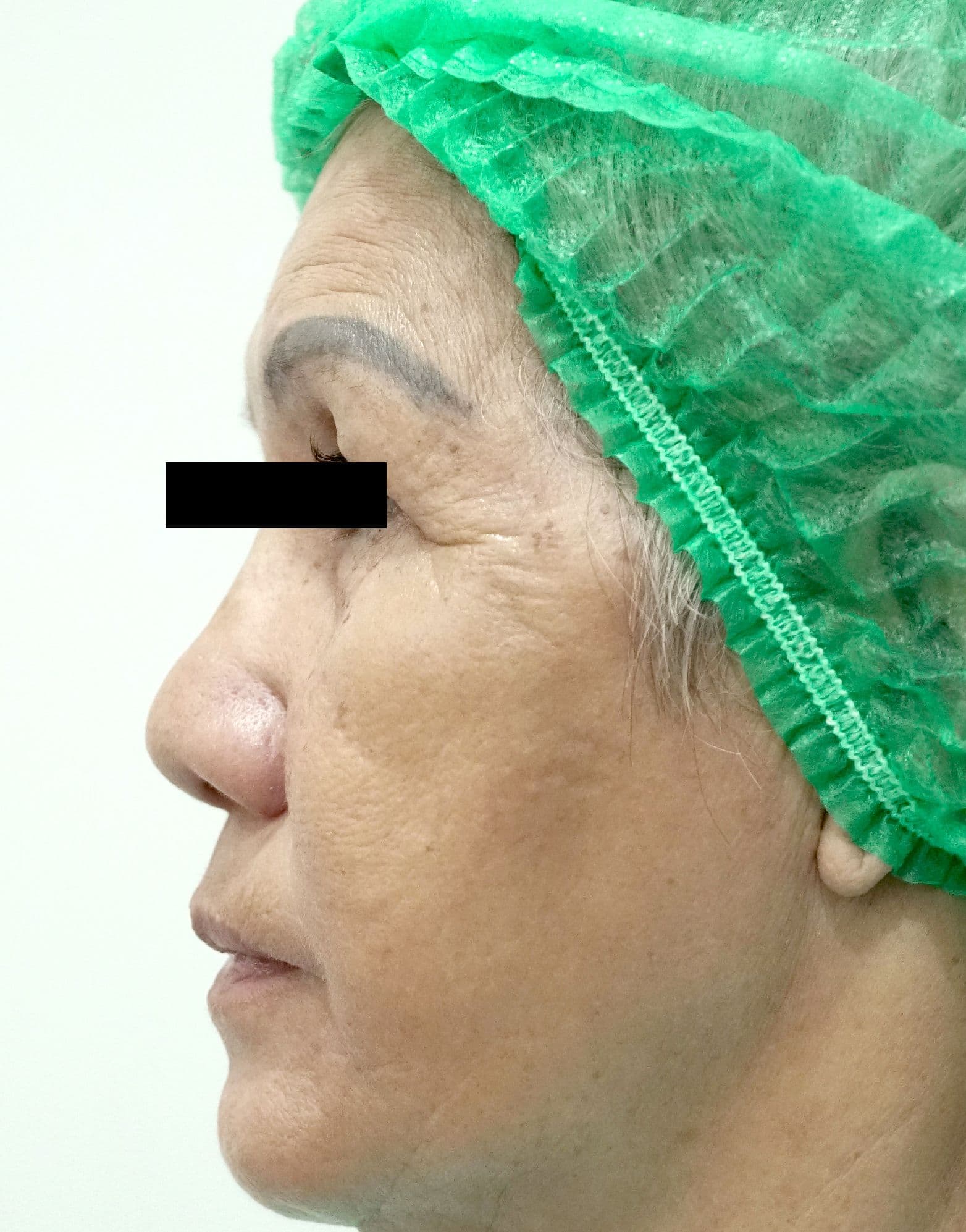 before image