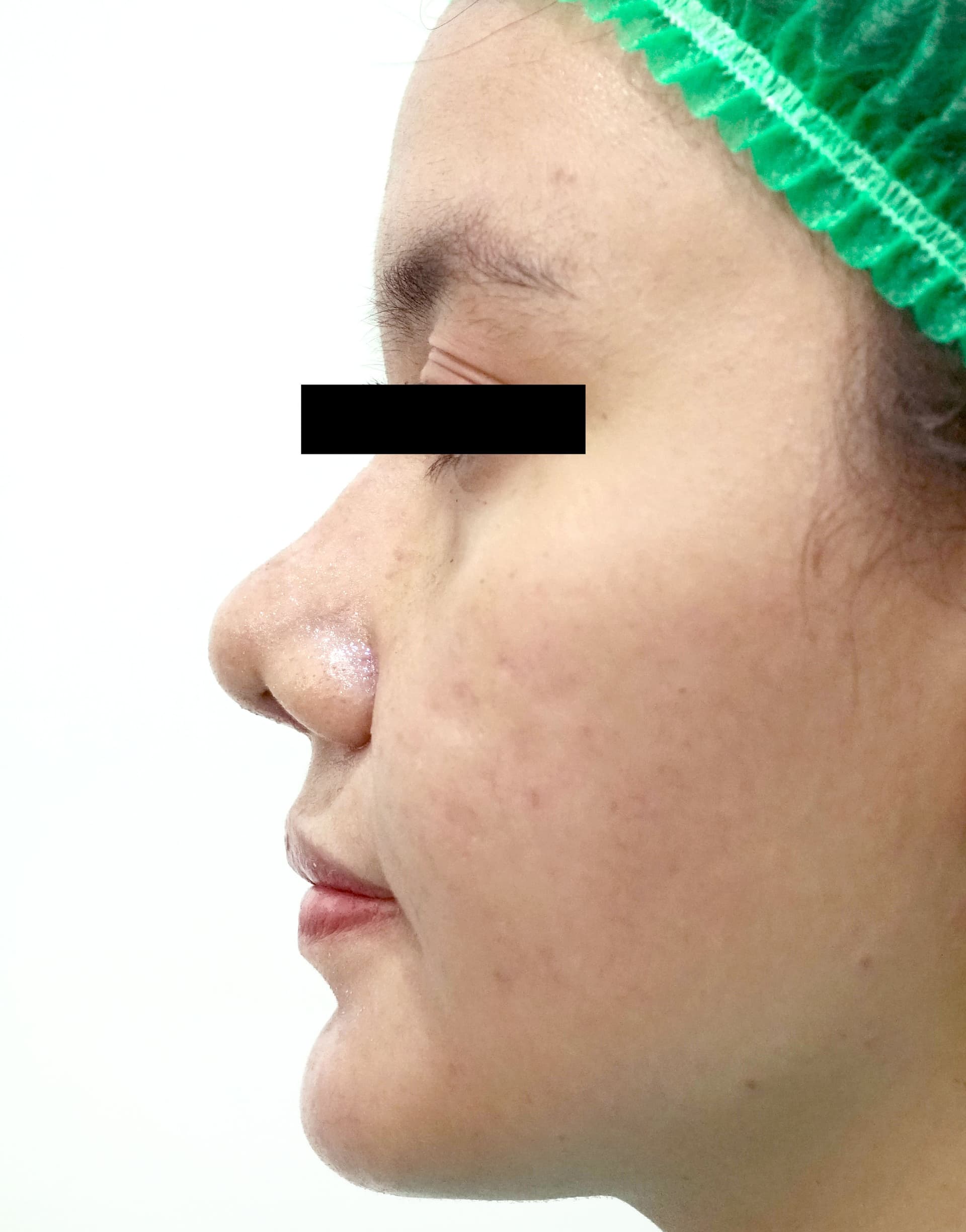 after image