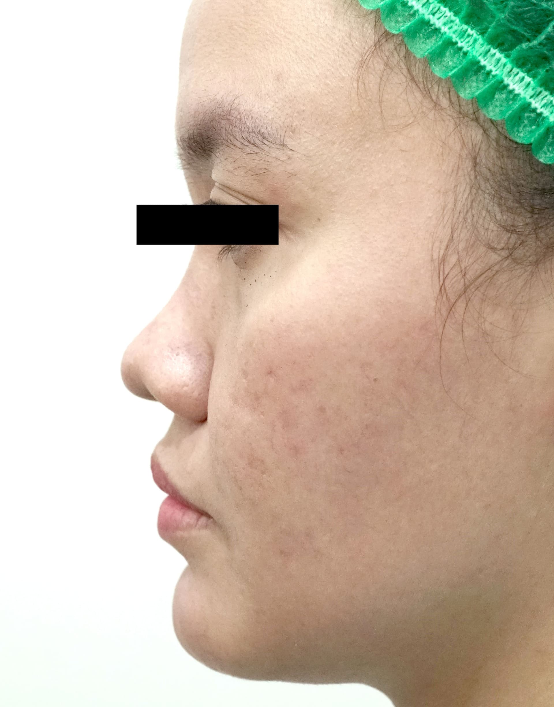 before image