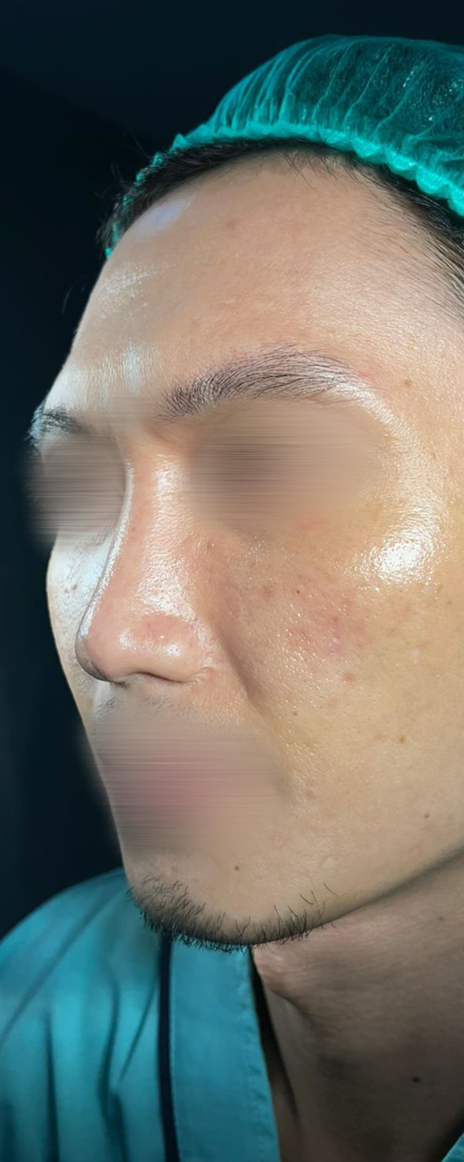 before image