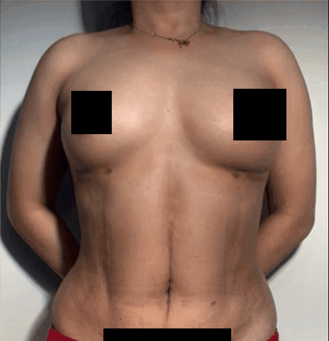 after image